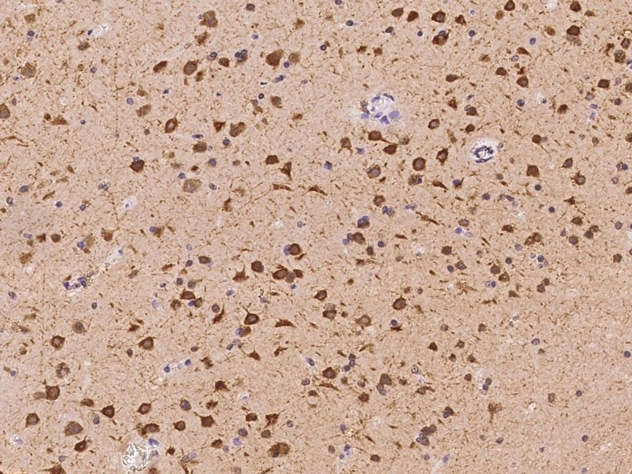 Polyclonal Rabbit anti-Human DLGAP3 / SAPAP3 Antibody (IHC)