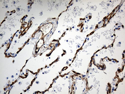 Monoclonal Mouse anti-Human CD34 Antibody (clone OTI8F11, aa312-385, IHC, WB)