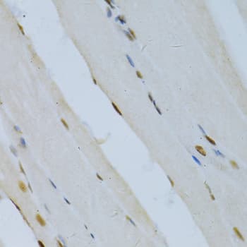 Polyclonal Rabbit anti-Human MAPK3 / ERK1 Antibody (IHC, IF, WB)