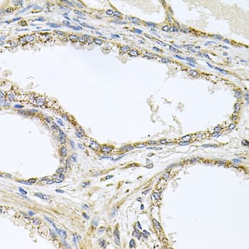 TNFRSF10A / DR4 Antibody