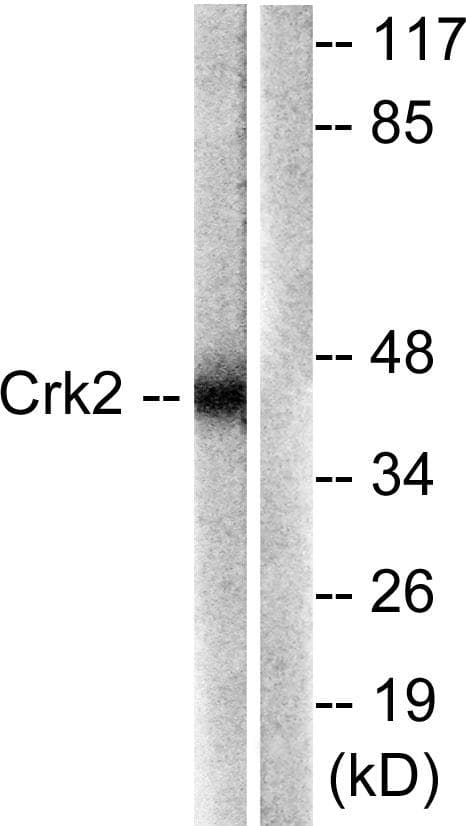 CRK Antibody (p221)