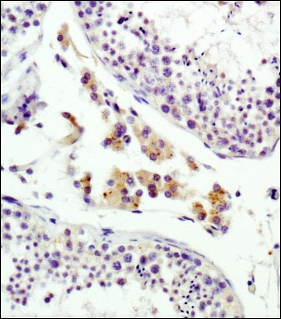 IGF2R / CD222 Antibody (clone 2G11)