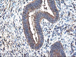 TUBAL3 Antibody (aa150-446, clone OTI2F6, Carrier-free)