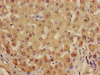 ADH2 / ADH1B Antibody