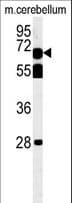 TBKBP1 Antibody (aa42-70)