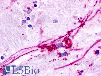 PathPlus™ GPR84 Antibody (Extracellular Domain)