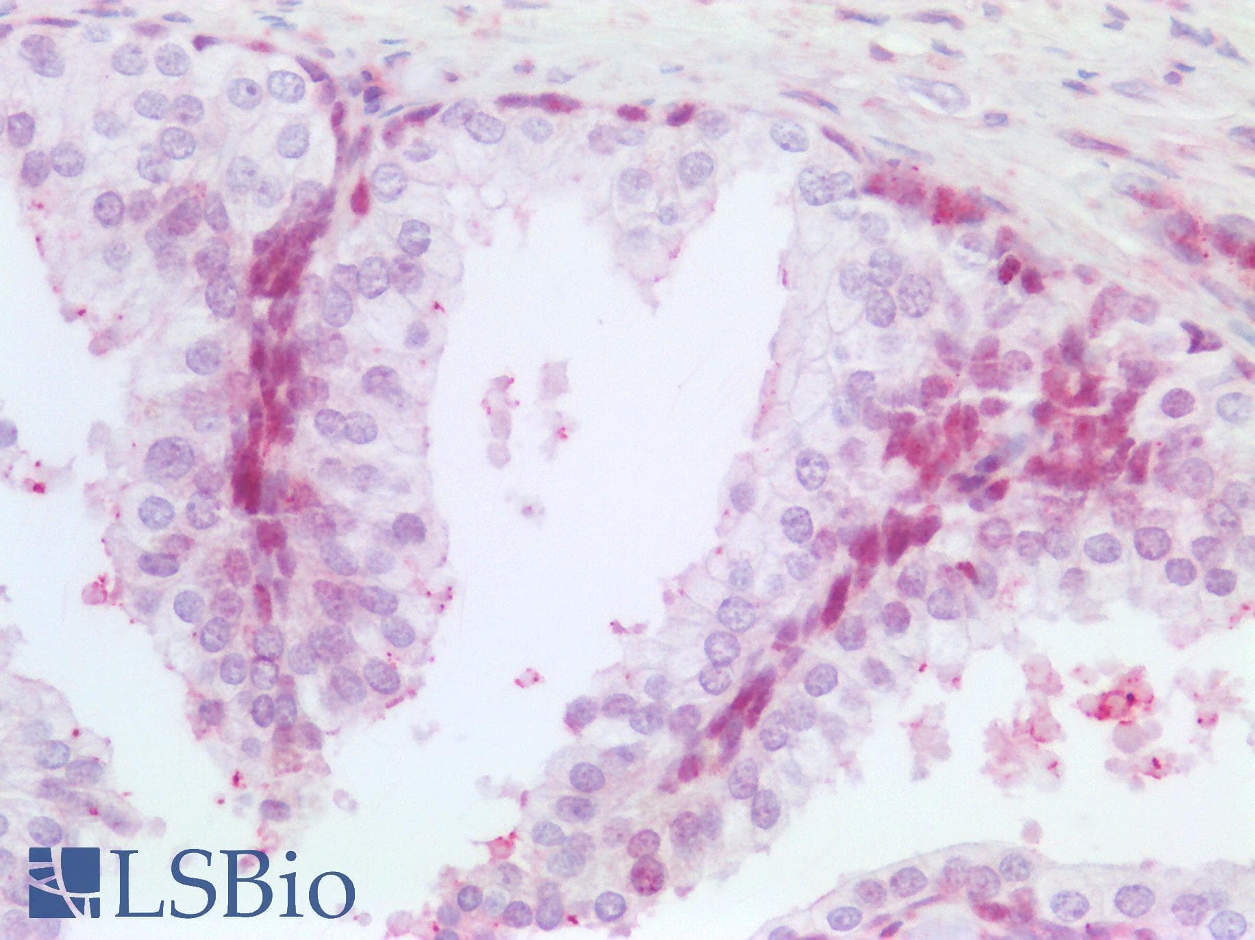 PathPlus™ NALP3 / NLRP3 Antibody (aa158-207)