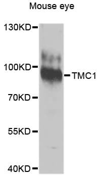 IHC-plus™ transmembrane channel-like 1 Antibody