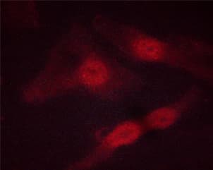 STAT5A Antibody (phospho-Ser725,pSer730)