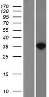 NAT1 / AAC1 Protein (Over-Expression Lysate Myc-DDK (Flag))