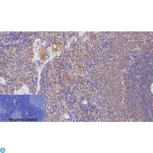 PDGFRA / PDGFR Alpha Antibody