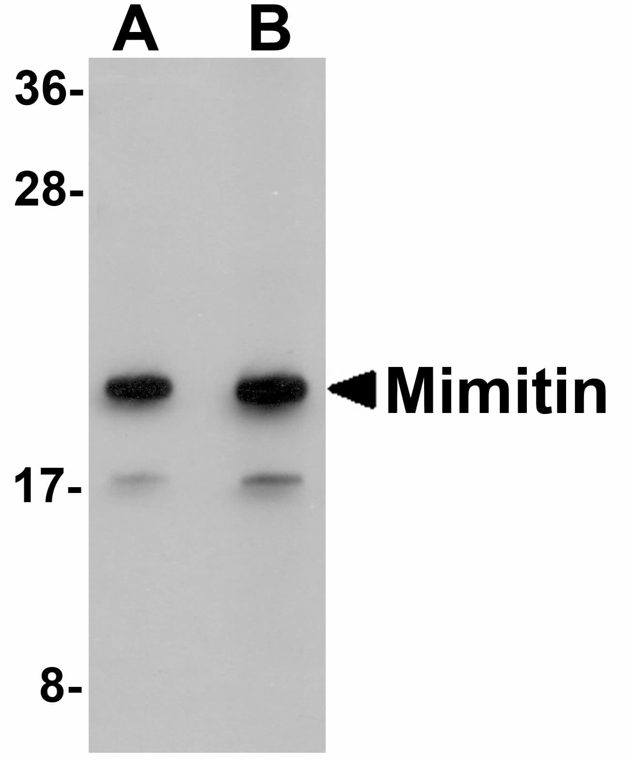 IHC-plus™ Polyclonal Rabbit anti-Human NDUFAF2 / NDUFA12L Antibody (IHC, IF, WB)