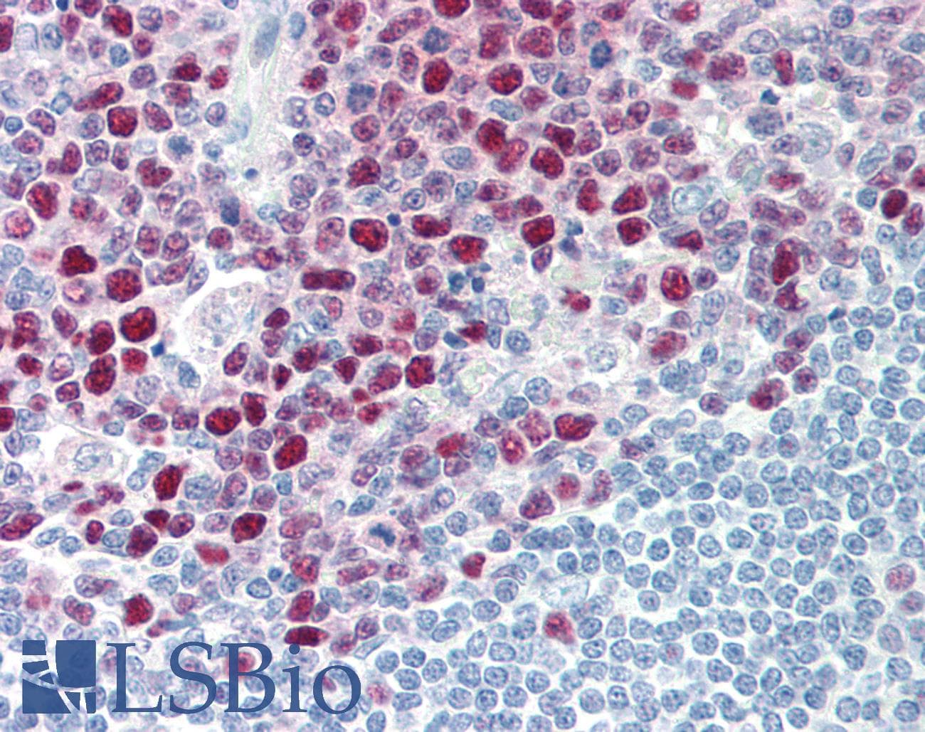 IHC-plus™ PCNA Antibody (clone ABT-PCNA)