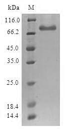 Human ESET / SETDB1 Protein (Recombinant GST, N-terminus)