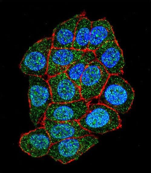 ASXL1 Antibody (aa521-549)