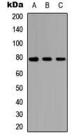NCKIPSD / AF3P21 Antibody (Internal)