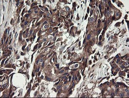 UBE2J1 Antibody (clone OTI3D1)
