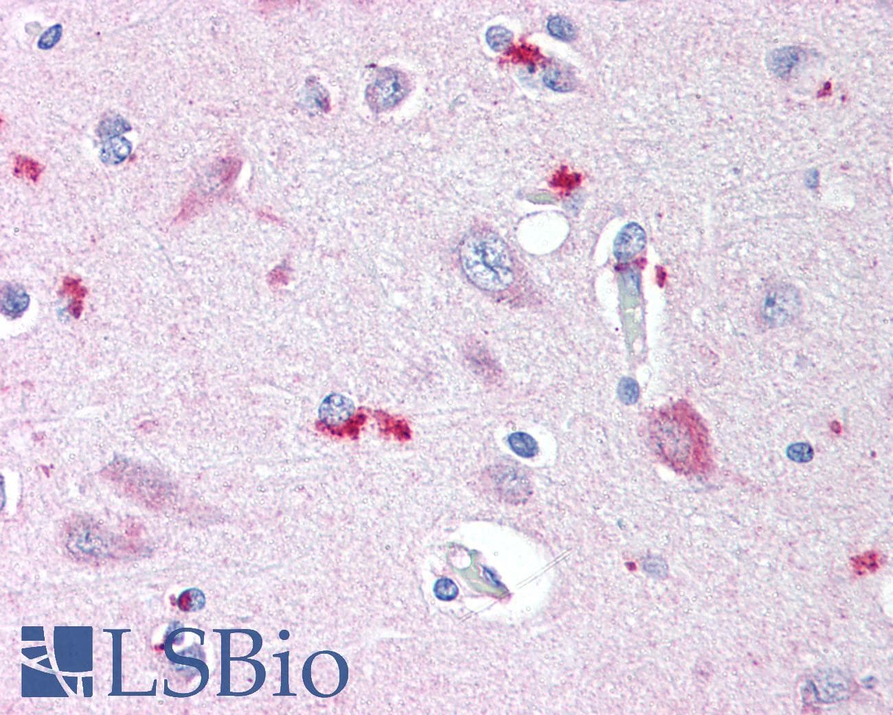 IHC-plus™ NPC / NPC1 Antibody (C-Terminus)