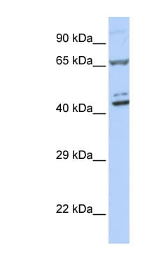 ZNF324 / ZF5128 Antibody (aa180-229)