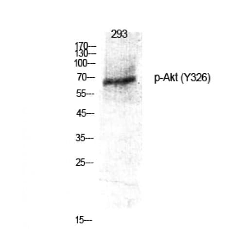 Polyclonal Rabbit anti-Human AKT1 Antibody (270-350 aa, WB)