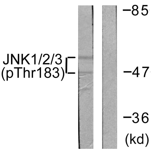JNK1+2+3 Antibody (phospho-Thr183)