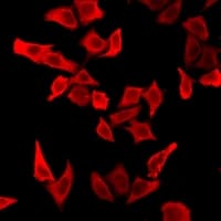 Tyrosine Aminotransferase Antibody