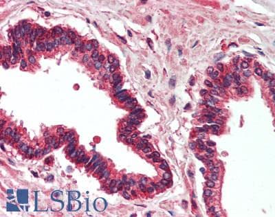 IHC-plus™ Polyclonal Rabbit anti-Human PSMD5 Antibody (aa255-504, IHC)