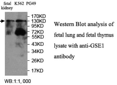IHC-plus™ Polyclonal Rabbit anti-Human GSE1 / KIAA0182 Antibody (aa463-636, IHC, WB)