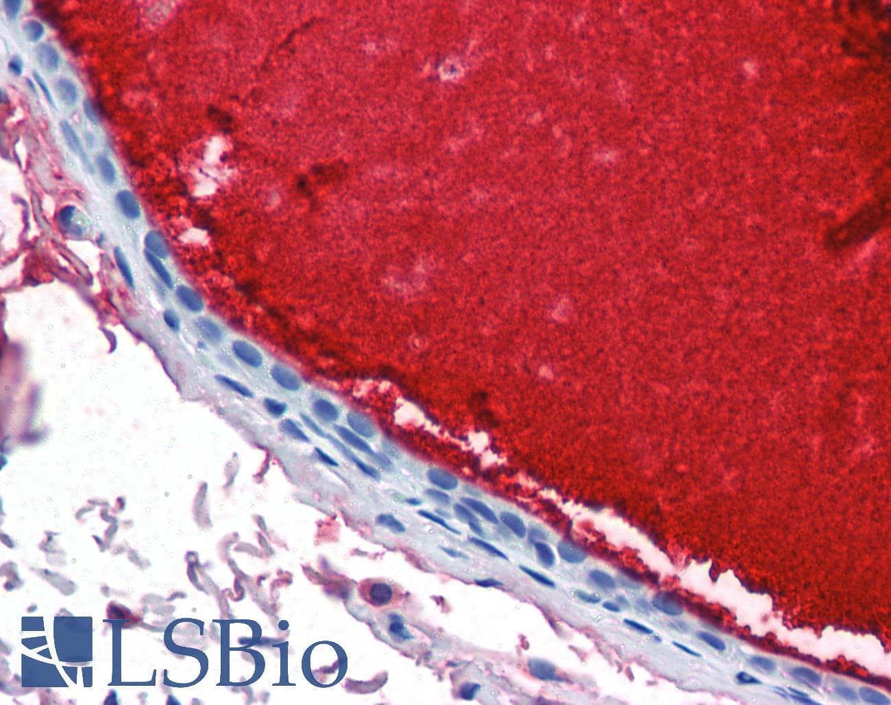IHC-plus™ Monoclonal Mouse anti-Human LF / LTF / Lactoferrin Antibody (clone 1A1, IHC, WB)