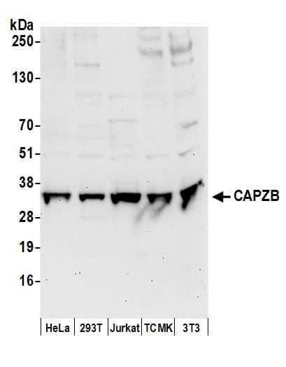 CAPZB / CAPZ Beta Antibody (aa25-75)