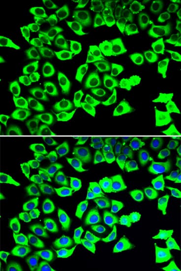Polyclonal Rabbit anti-Human RPLP2 Antibody (IHC, IF, WB)