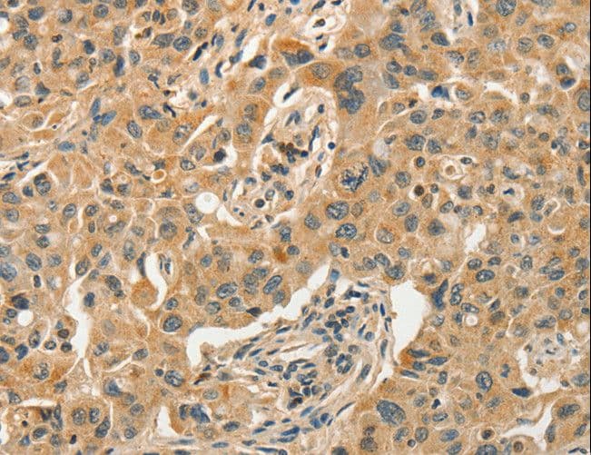 SLC11A2 / DMT1 Antibody