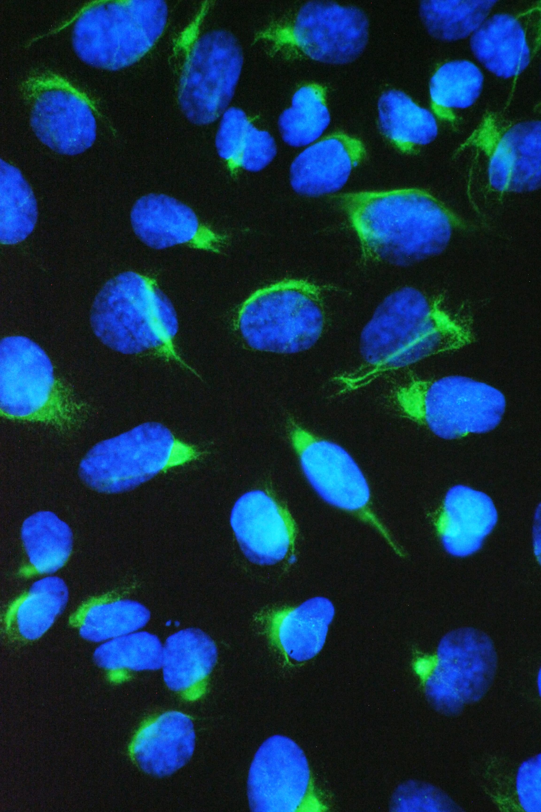 CCT7 Antibody
