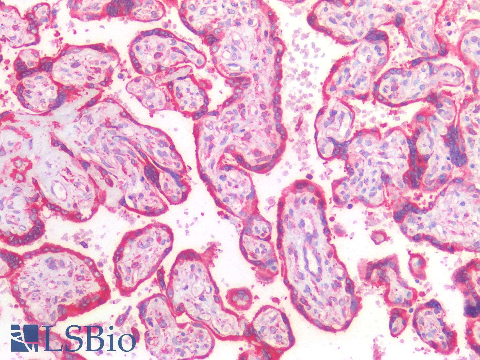 IHC-plus™ HSPA5 / GRP78 / BiP Antibody