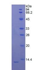 Rat S100B / S100 Beta Protein (Native His, N-Terminal)