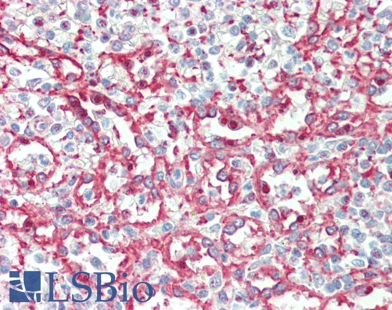 ITGA2B / CD41 Antibody (aa122-171, FITC)