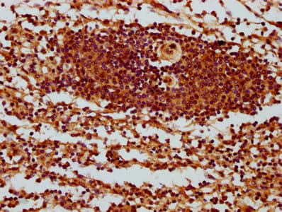 Polyclonal Rabbit anti-Human SH3BP1 Antibody (IHC)