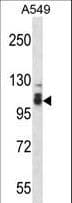 SMEK2 Antibody (aa720-748)
