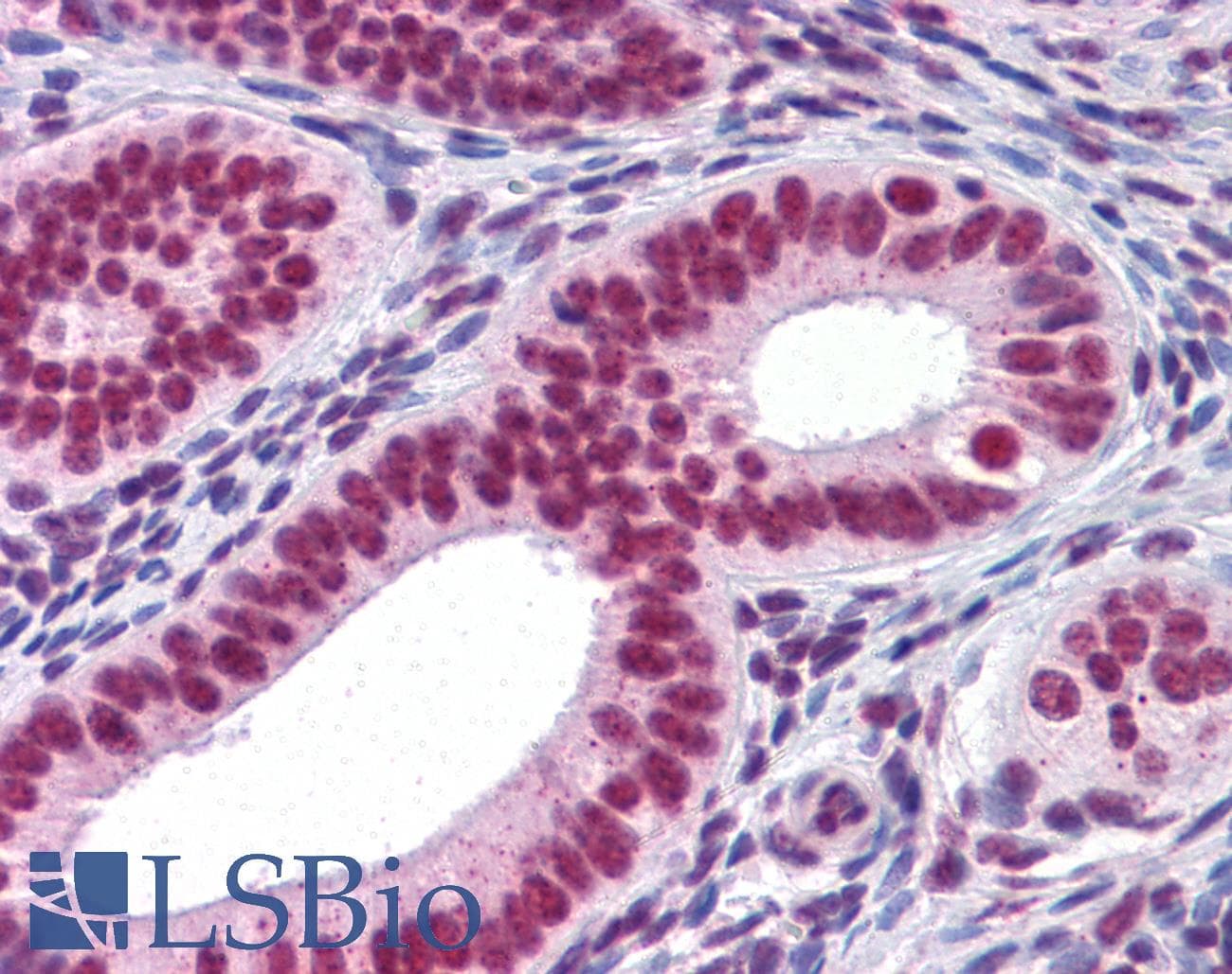 IHC-plus™ CBFA1 / RUNX2 Antibody (clone 3F5)