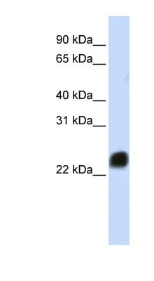 HMG1 / HMGB1 Antibody (N-Terminus)