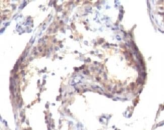 TGFA / TGF Alpha Antibody (clone TGFA/1119)