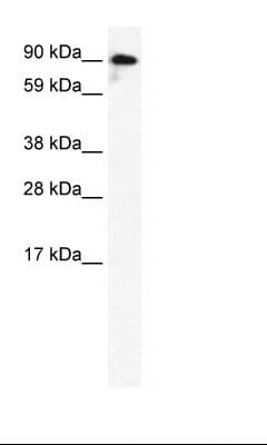 Polyclonal Rabbit anti-Human GRIK2 / GLUR6 Antibody (aa652-701, IHC, WB)