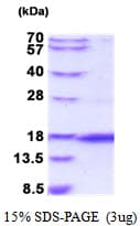 Human OTOR / Otoraplin Protein (Recombinant His)