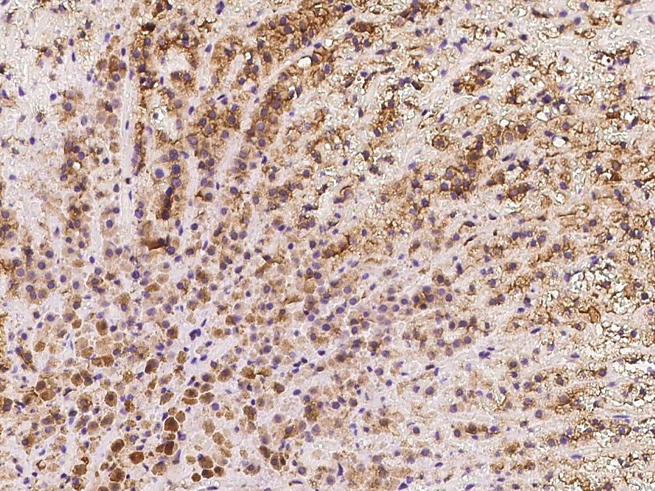 Polyclonal Rabbit anti-Human KCNQ1 / KVLQT1 Antibody (IHC)