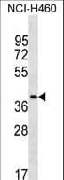 ZNF488 Antibody (aa149-175)