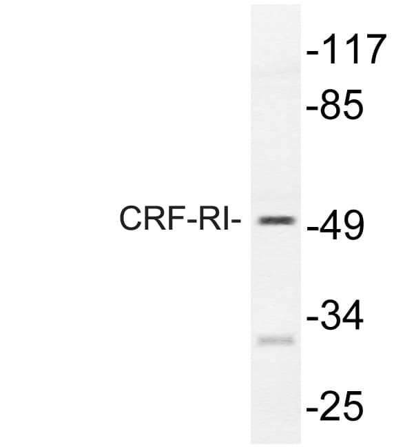 CRFR1 / CRHR1 Antibody (His177)