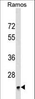 Polyclonal Rabbit anti-Human BRI3BP Antibody (aa157-183, WB)