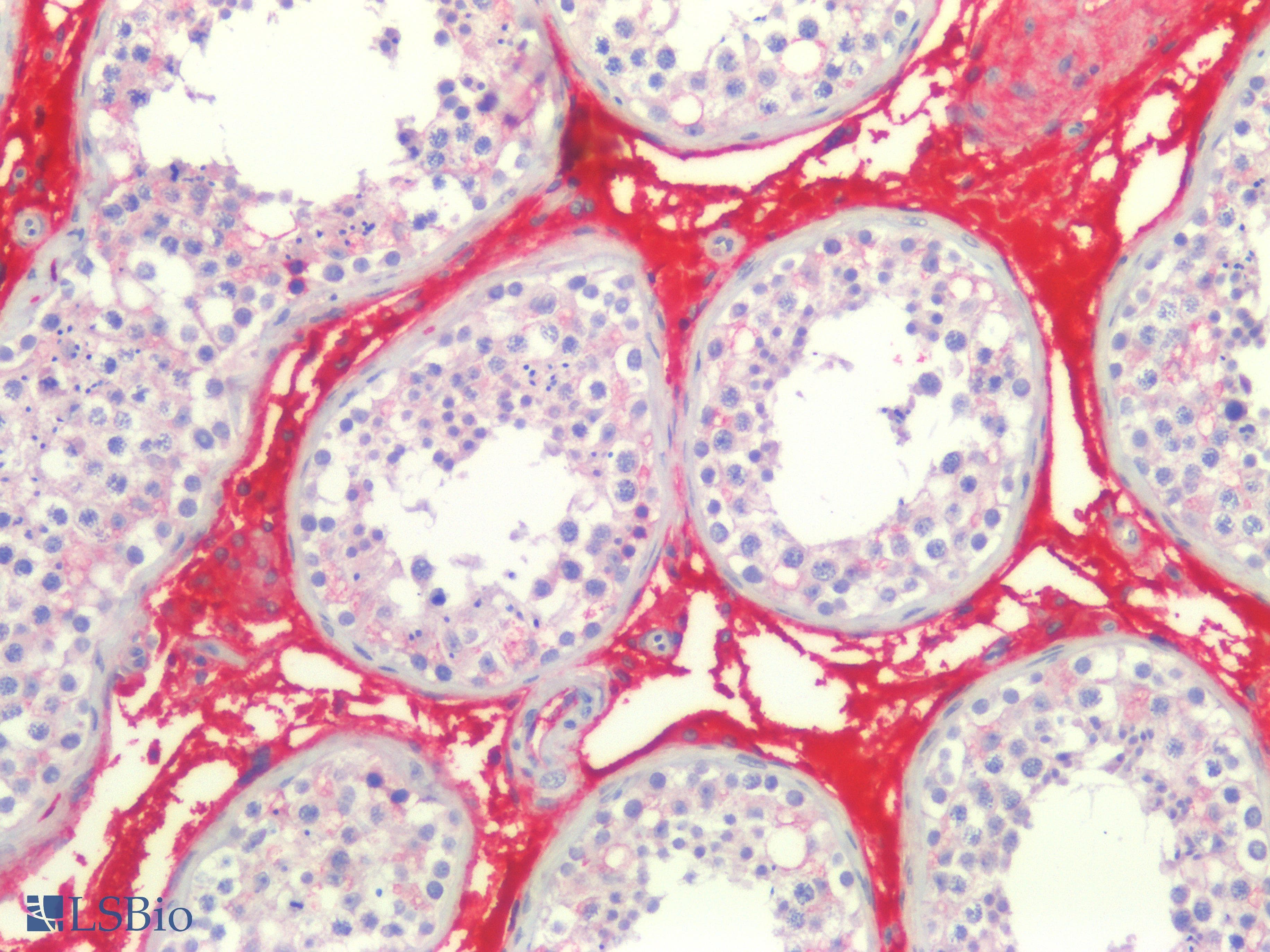 IHC-plus™ LAMA1 / Laminin Alpha 1 Antibody