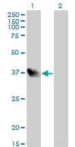 LZTFL1 Antibody (clone 7F6)
