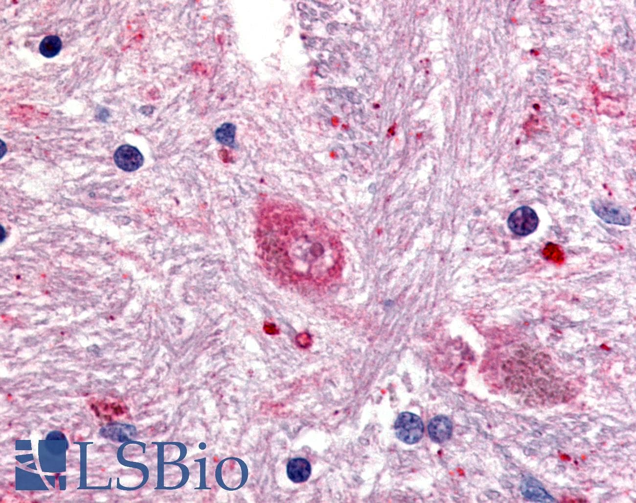 IHC-plus™ Polyclonal Rabbit anti-Human GPR88 Antibody (Cytoplasmic Domain, IHC)